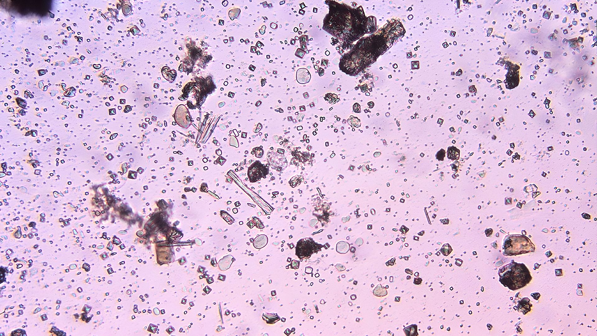 Experimental Treatment Targets Drug-Resistant Infection